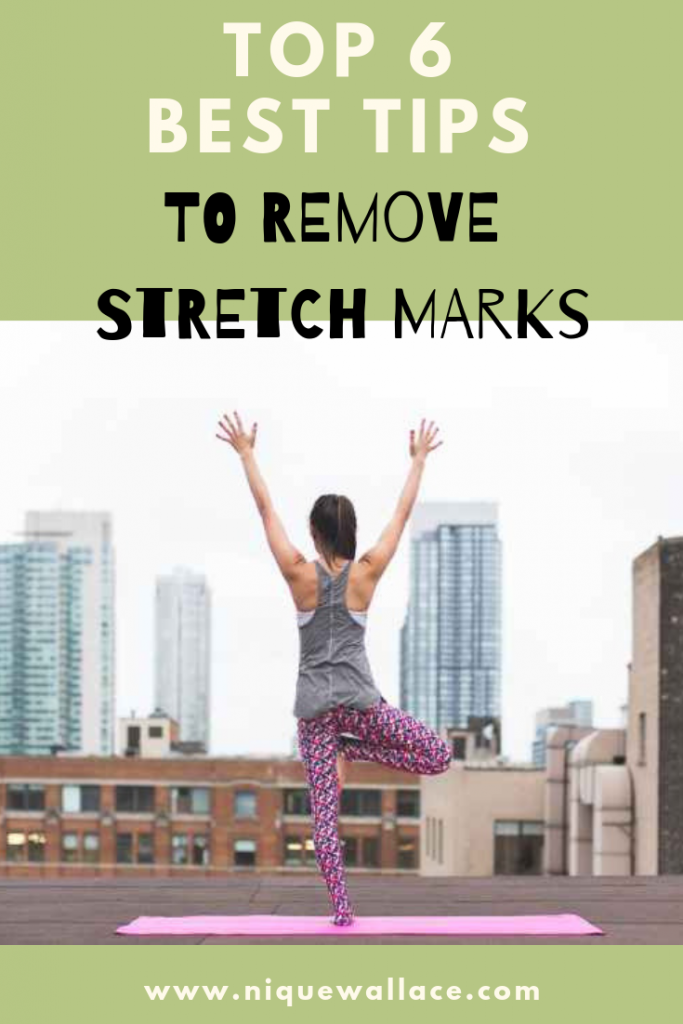 Top 6 Best Tips to Remove Stretch Marks
